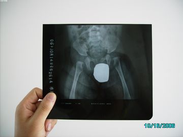 فیلم تصویربرداری پزشکی کم مه برای پرینتر X-ray برای AGFA / Fuji / Kodak