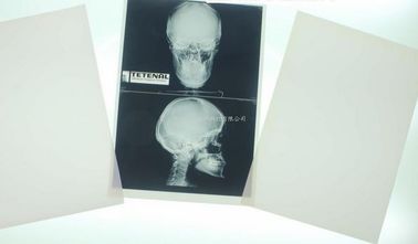 تصویربرداری پزشکی اشعه ایکس کونیدا 10 اینچ X 12 اینچ