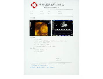 فیلم پزشکی پرتوی ایکس مقاوم در برابر خراش برای KND-DRYTEC-3000 ، KND-DRYTEC-4000