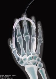 فیلم تصویربرداری خشک پزشکی شفاف ، فیلم دیجیتال X X حرارتی آگفا