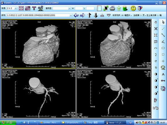 قیمت خوب چاپگر لیزری X ray Diagnostic تصویربرداری نقره ای Halide برای KND-DRYTEC 4000 آنلاین