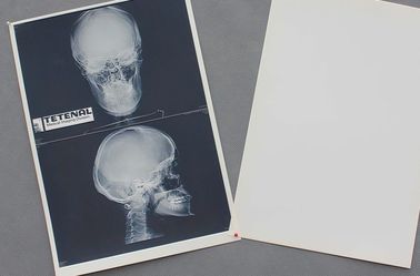 Good price کاغذ پزشکی سفید قفسه سینه X ray فیلم ضد وضوح بالا آنلاین