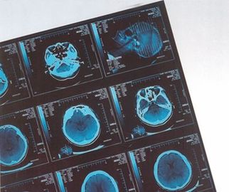 Good price حرارتی فیلم دیجیتال X X Ray Thermal برای بیمارستان CR / DR آنلاین