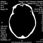 10 x 14 اشعه ایکس فیلم تصویربرداری خشک پزشکی حرارتی حساس برای چاپگر فوجی