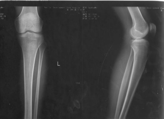 قیمت خوب فیلم تصویربرداری با لیزر پزشکی کاغذ 32cm * 43cm Xray برای KND-DRYTEC-4000 KND-K آنلاین