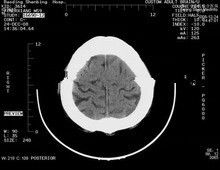 قیمت خوب فیلم های Xray X Paper Paper Xray مقاوم در برابر خراش برای چاپگرهای لیزری Konida آنلاین