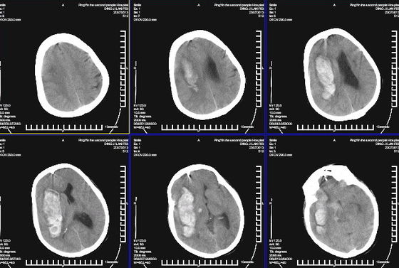 قیمت خوب KND-K ضد آب تصویربرداری تشخیصی پزشکی ضد آب KNA برای چاپگر لیزری Konida آنلاین