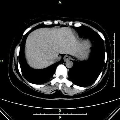 قیمت خوب کاغذ آبی لیزر تصویربرداری نازک Konida X Ray برای دستگاه Xray آنلاین