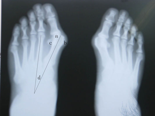 قیمت خوب تصویربرداری تشخیصی ضد آب ایکس ضد آب آنلاین