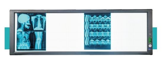 قیمت خوب جعبه نمایشگر فوق روشن پزشکی LED آنلاین