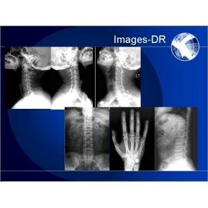 قیمت خوب دستگاه رادیوگرافی دیجیتال Mammogrpahy X-RAY با بازوی انعطاف پذیر UC آنلاین