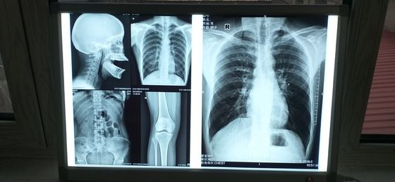 قیمت خوب سطح براق فیلم جوهر افشان پزشکی سیلک اسکرین ضد آب آنلاین