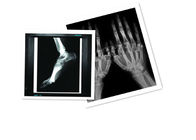 کاغذ Hosipital PET Film Medical X ضد آب 8 × 10 اینچ CT فیلم سفید