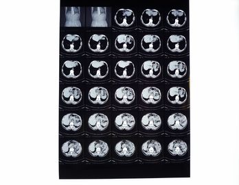 Drypix 2000 X Ray خشک فیلم 8 10 10 اینچ مقاومت در برابر خراش برای فوجی 3000