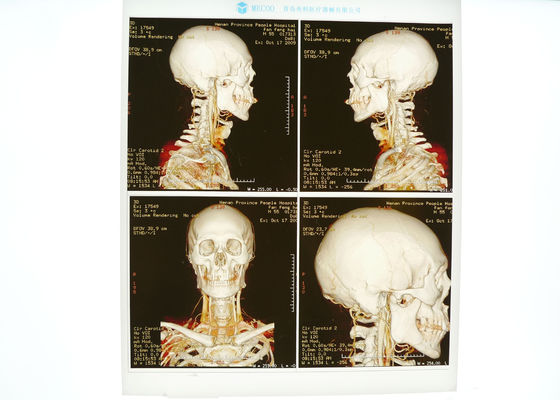 قیمت خوب برای پرینترهای لیزری کونیدا ، پرچم پزشکی X X ، با چگالی بالا آنلاین