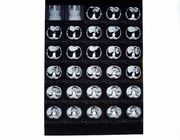 فیلم های اشعه ایکس پزشکی ، فیلم تصویربرداری خشک سازگار با چاپگر حرارتی برای CT / DR / MRI