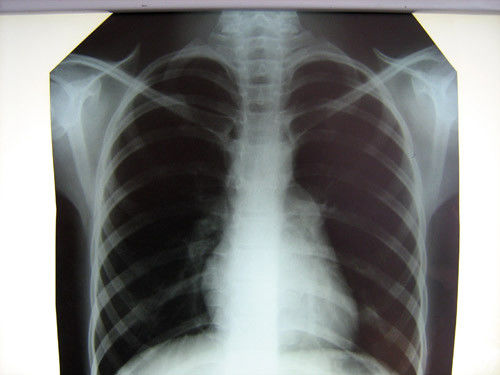 شفاف فیلم X-ray پزشکی بیمارستان Konida با چاپگرهای حرارتی