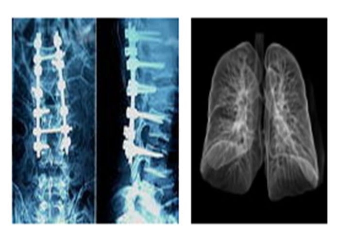 فیلم Sharp Radiographic Medical X Ray Films ، فیلم تصویربرداری خشک دیجیتال Mri Dr Ct