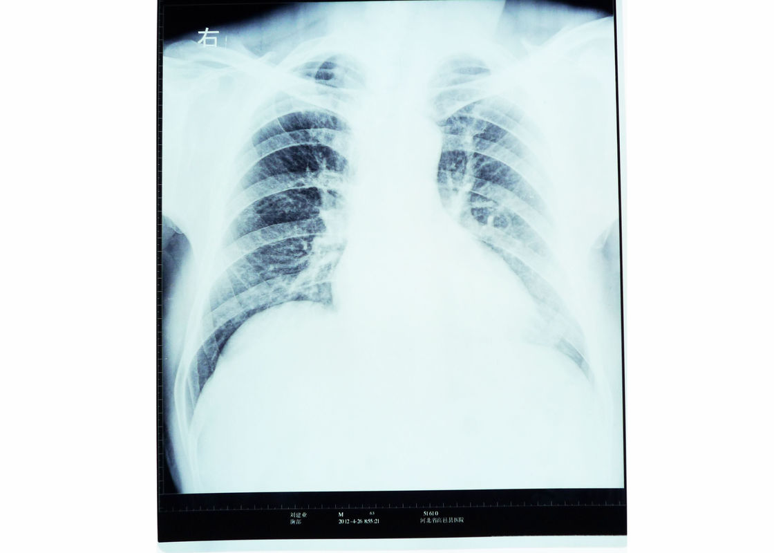 فیلم اشعه ایکس فیلمبرداری خشک پزشکی برای AGFA 5300/5302/5500 KND-A