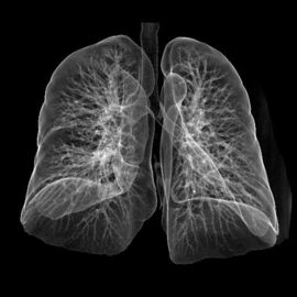 Good price لیزر لیزری کونیدا با کیفیت بالا با وضوح بالا فیلم X-ray پزشکی برای CT / DR آنلاین
