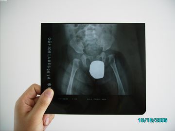 Good price تصویربرداری با لیزر نقره ای Halide X ray ، ضد آب نازک Agfa DRYSTAR DT1B / DT2B آنلاین