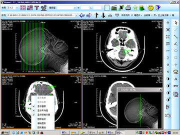 تصویربرداری تشخیصی تشخیصی با لیزر کاغذ پزشکی 8 x 10 اینچ برای KND-DRYTEC 4000