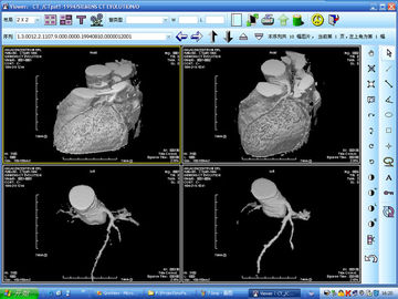 Good price چاپگر لیزری X ray Diagnostic تصویربرداری نقره ای Halide برای KND-DRYTEC 4000 آنلاین