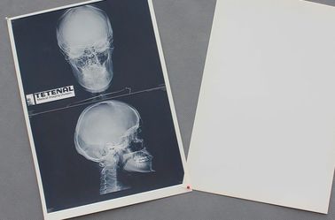 کاغذ پزشکی سفید قفسه سینه X ray فیلم ضد وضوح بالا