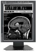 صفحه نمایش پزشکی 2MP با کیفیت بالا پزشکی