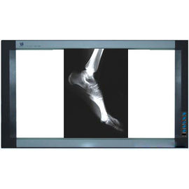 فیلم تصویربرداری پزشکی هولوگرافی ، چاپگرهای حرارتی PET X Ray Film