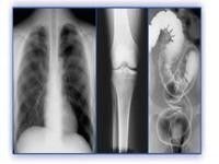 فیلم تصویربرداری پزشکی هولوگرافی ، چاپگرهای حرارتی PET X Ray Film
