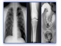 Good price فیلم تصویربرداری پزشکی هولوگرافی ، چاپگرهای حرارتی PET X Ray Film آنلاین