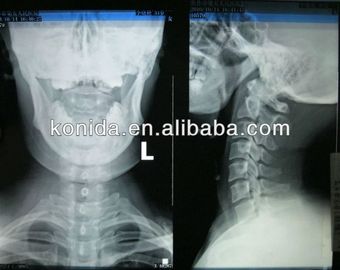 Good price تصویربرداری تشخیصی پزشکی با وضوح بالا ، فیلم AGFA X خشک خشک آنلاین