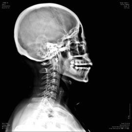 Good price فیلم شفافیت پزشکی دیجیتال Xray پزشکی با چگالی بالا KND-F برای فوجی 3000 ، 2000 ، 1000 آنلاین