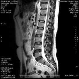Good price رطوبت اثبات شده سفت و سخت Ripid Medical X Ray Film 8in x 10in برای چاپگر حرارتی آنلاین