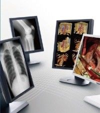 Good price تصویر روشن نمایشگر درجه پزشکی ، نمایشگر پزشکی مقیاس خاکستری 5MP آنلاین