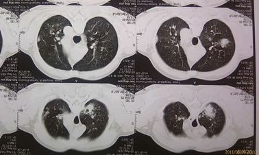 Good price فیلم خشک طبی سازگار با محیط زیست Agfa 2B X Ray با دستگاه CT آنلاین