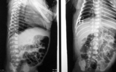 Good price فیلم های X ray 10 14 14 اینچ خشک پزشکی برای فوجی 3000/2000/1000 آنلاین