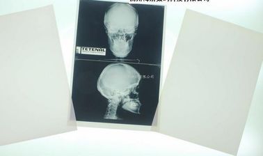 Good price فیلم پزشکی پزشکی قابل تجزیه سفید پایه Xray برای چاپگر لیزری آنلاین