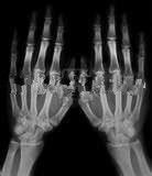 Good price 13in * 17in فیلم Xray Medical Xog Low Paper برای چاپگر لیزری کونیدا آنلاین