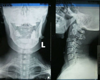Good price کاغذ Xray برای تصویربرداری پزشکی Konida با قابلیت وضوح بالا و قابل تحمل برای چاپگر لیزری آنلاین