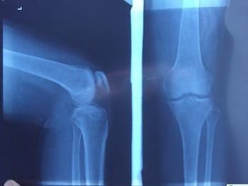 Good price تصویربرداری تشخیصی آبی اشعه ایکس ، فیلم لیزری پزشکی Xray فیلم عکاسی آنلاین