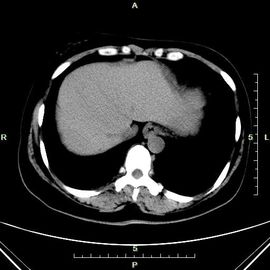 Good price کاغذ آبی لیزر تصویربرداری نازک Konida X Ray برای دستگاه Xray آنلاین
