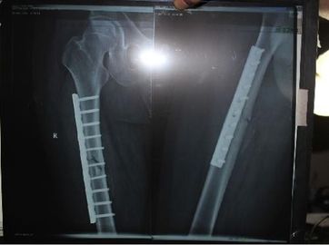 Good price فیلم Xray فیلم نازک برای محیط زیست برای چاپگر لیزری KND DRYTEC 3000 آنلاین
