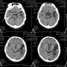 Good price تصویربرداری پزشکی X Ray مقاوم در برابر خراش برای چاپگر لیزری Konida آنلاین
