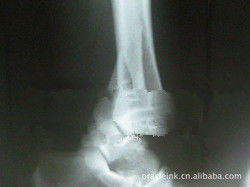 لیزر کاغذ سفید تصویربرداری پزشکی X Ray X 8 ضد 10 ضد آب