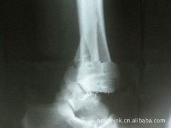 Good price لیزر کاغذ سفید تصویربرداری پزشکی X Ray X 8 ضد 10 ضد آب آنلاین
