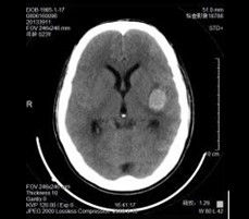 Good price مقاوم در برابر حرارت فیلم X-ray پزشکی با وضوح بالا 35 43 43 سانتی متر آنلاین