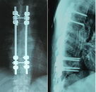 فیلم تصویربرداری پزشکی X Ray Dry آبی 8 10 10 اینچ برای آگفا / فوجی