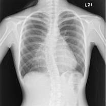 Good price White Base Medical لیزر X ray خشک فیلم 10 12 12 اینچ قابل تخریب آنلاین